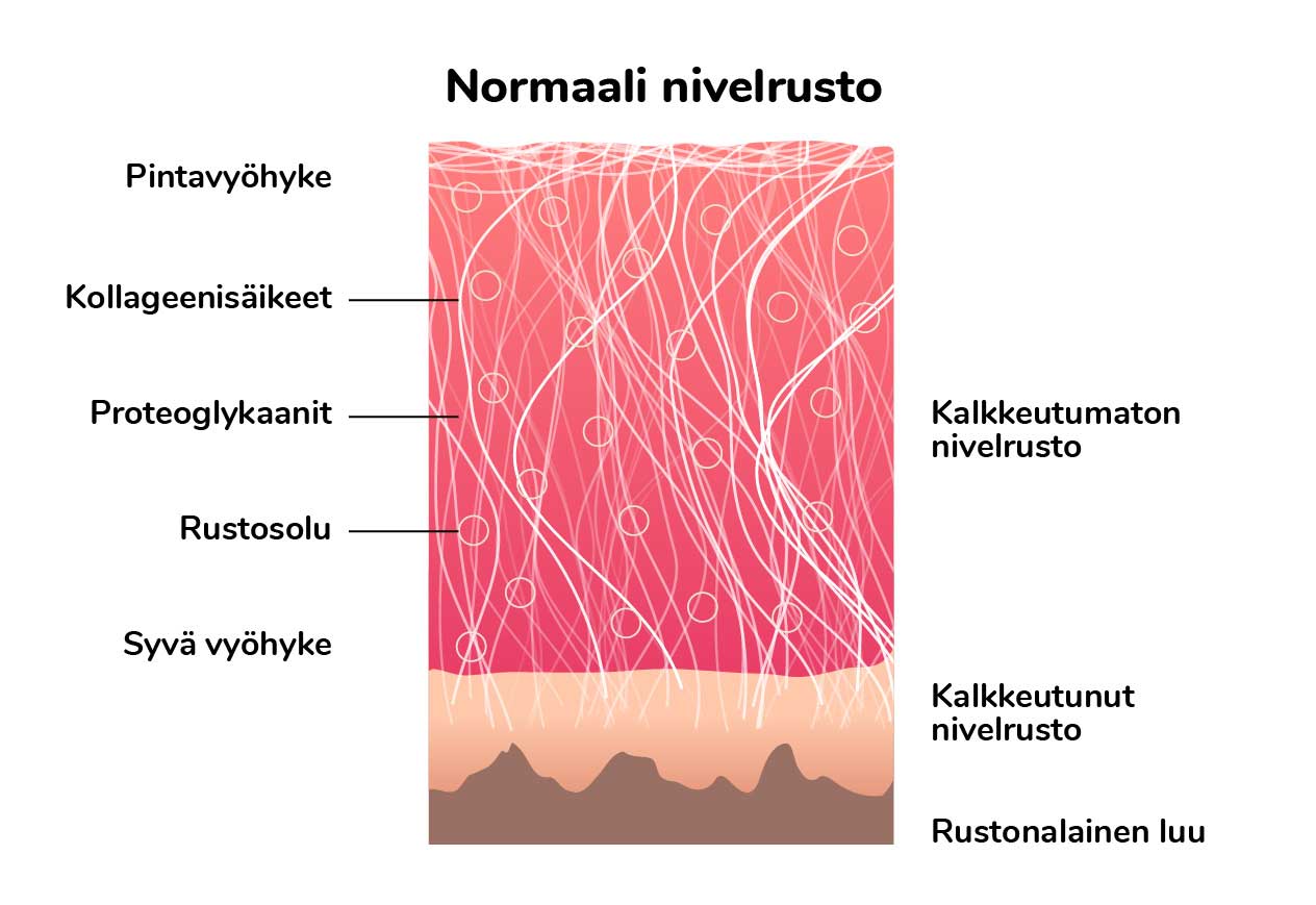 Hoida Nivelrikkoa